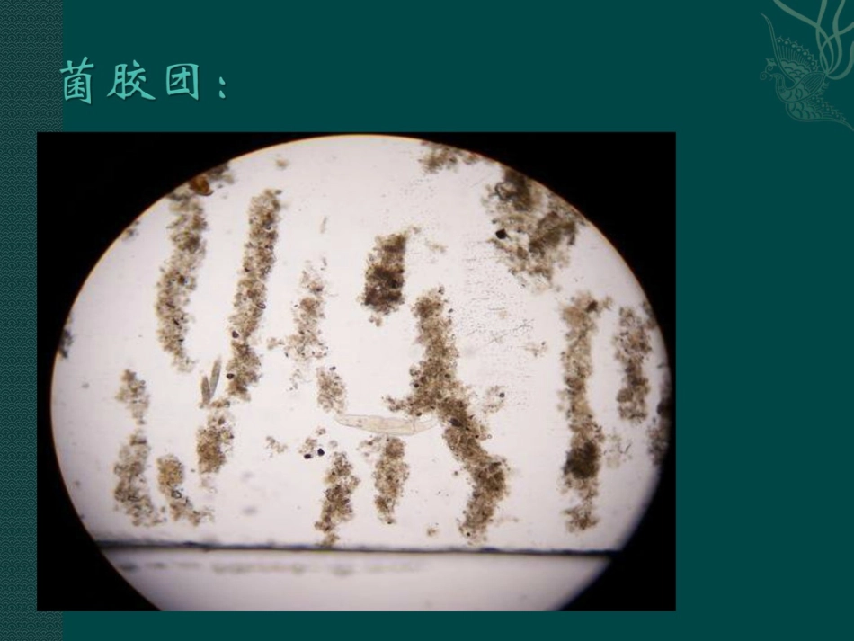 污水处理厂日常管理及常见问题的处理_第3页