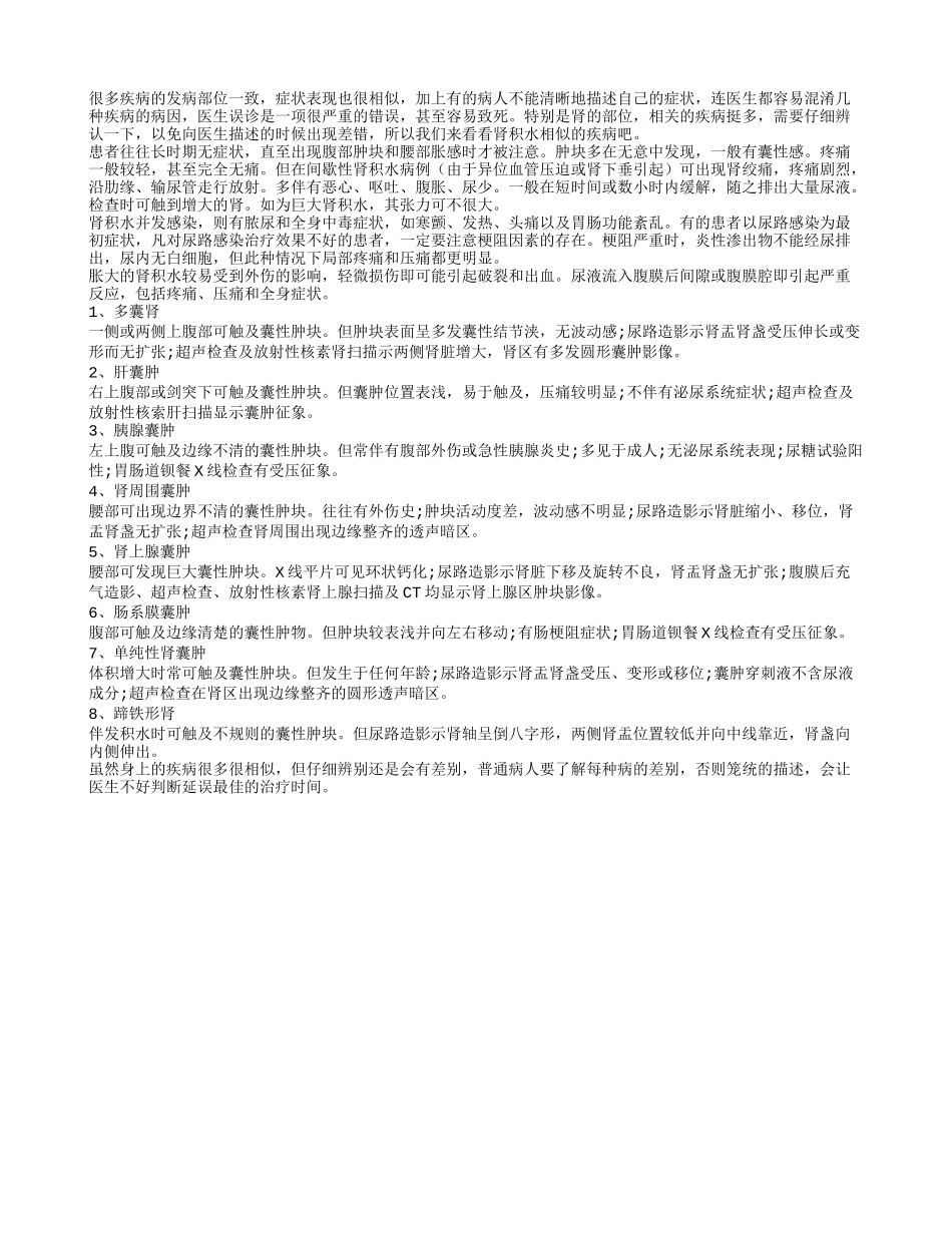 避免误诊鉴别肾积水相似的疾病_第1页